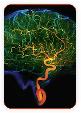 Syngo-Neuro-PBV-IR-parenchymal-blood-volume.png